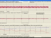 eq8_guiding_pe_graph